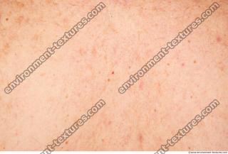 human skin hairy 0003